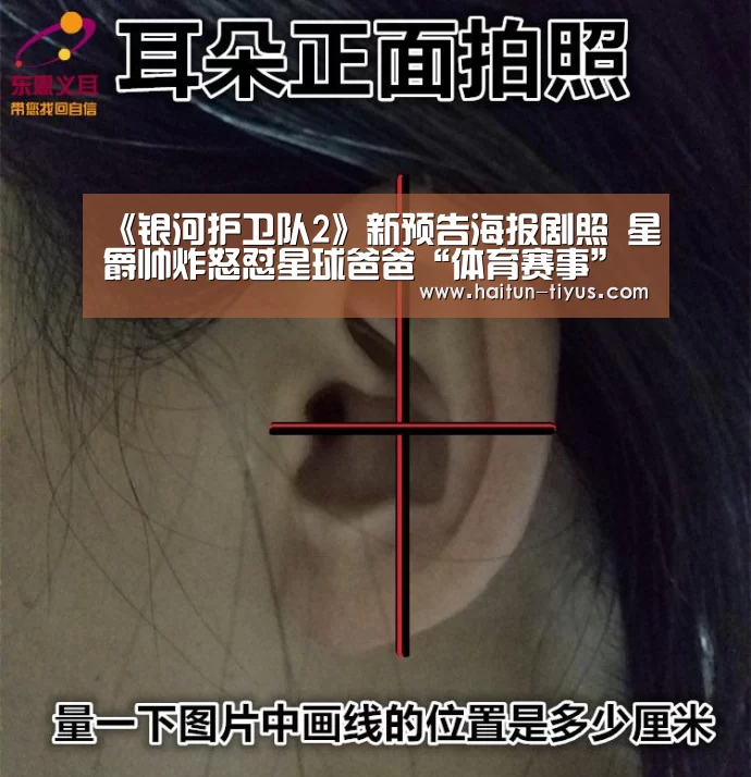 体育问答